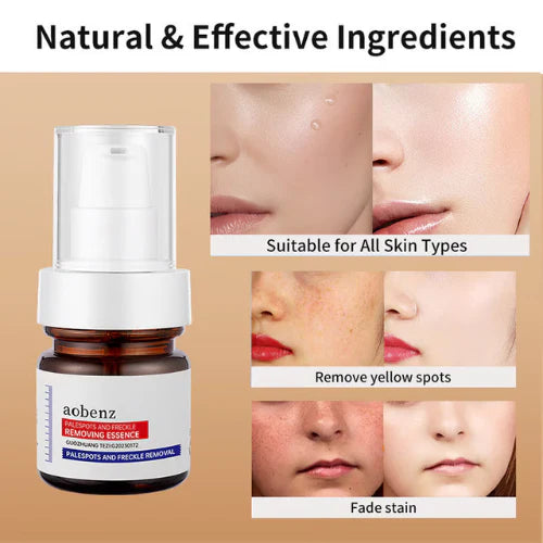 โค๏ธ ORIGINAL ๐๐ก๐ข๐ญ๐๐ง๐ข๐ง๐ and ๐
๐ซ๐๐๐ค๐ฅ๐ Removing Essence, Vitamin C ๐๐ฅ๐๐ฆ๐ข๐ฌ๐ก Serum for ๐๐๐ฅ๐๐ฌ๐ฆ๐ ๐๐๐ฆ๐จ๐ฏ๐๐ฅ, ๐๐ง๐ญ๐ข-๐ฌ๐ฉ๐จ๐ญ Face Serum (๐ฅBuy 1 Get 1 FREE Today Only) - Pack of 2