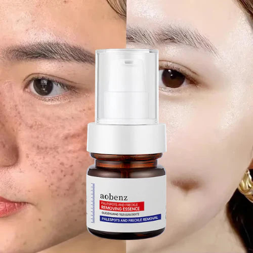 โค๏ธ ORIGINAL ๐๐ก๐ข๐ญ๐๐ง๐ข๐ง๐ and ๐
๐ซ๐๐๐ค๐ฅ๐ Removing Essence, Vitamin C ๐๐ฅ๐๐ฆ๐ข๐ฌ๐ก Serum for ๐๐๐ฅ๐๐ฌ๐ฆ๐ ๐๐๐ฆ๐จ๐ฏ๐๐ฅ, ๐๐ง๐ญ๐ข-๐ฌ๐ฉ๐จ๐ญ Face Serum (๐ฅBuy 1 Get 1 FREE Today Only) - Pack of 2