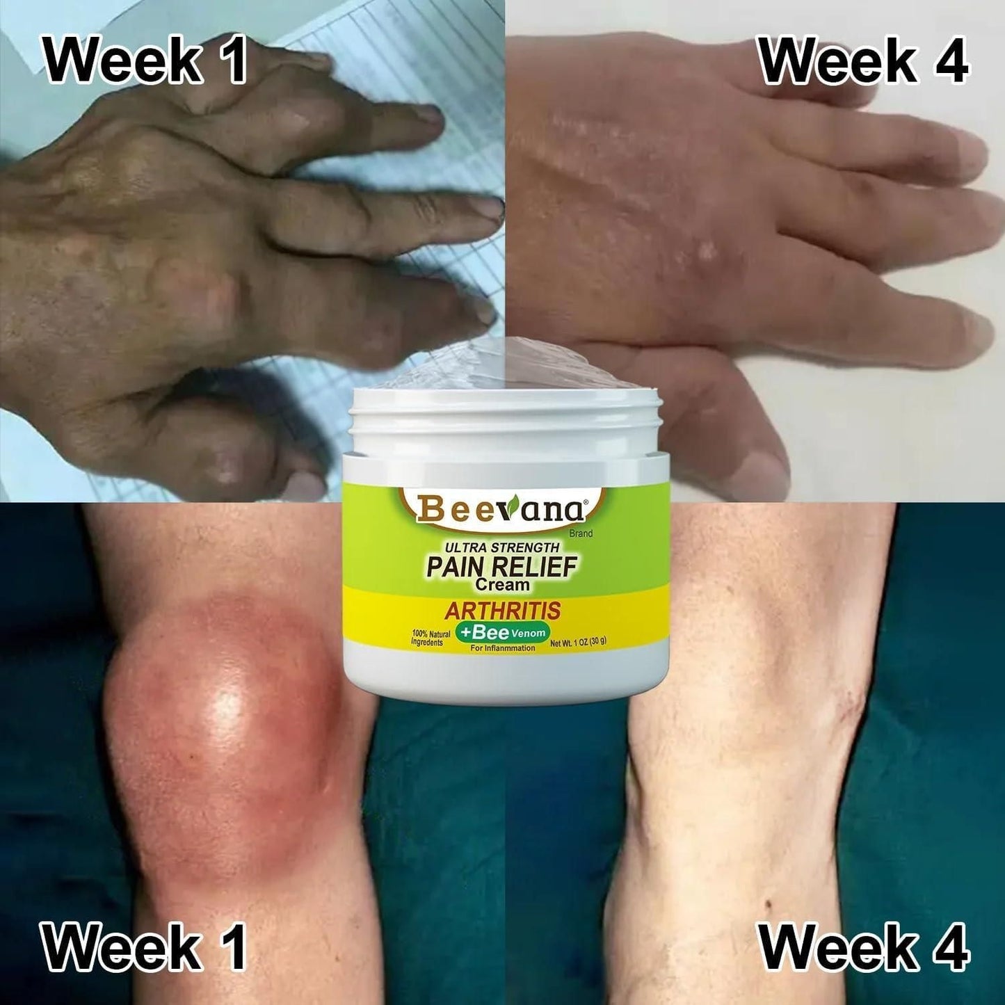 ❤️New Zealand's Discovery❤️ Bee Venom Joint and Bone Therapy Cream ( Buy 1, Get 1 FREE! 💕, Pack of 2) 🏆🏆 AWARD WINNING PRODUCT