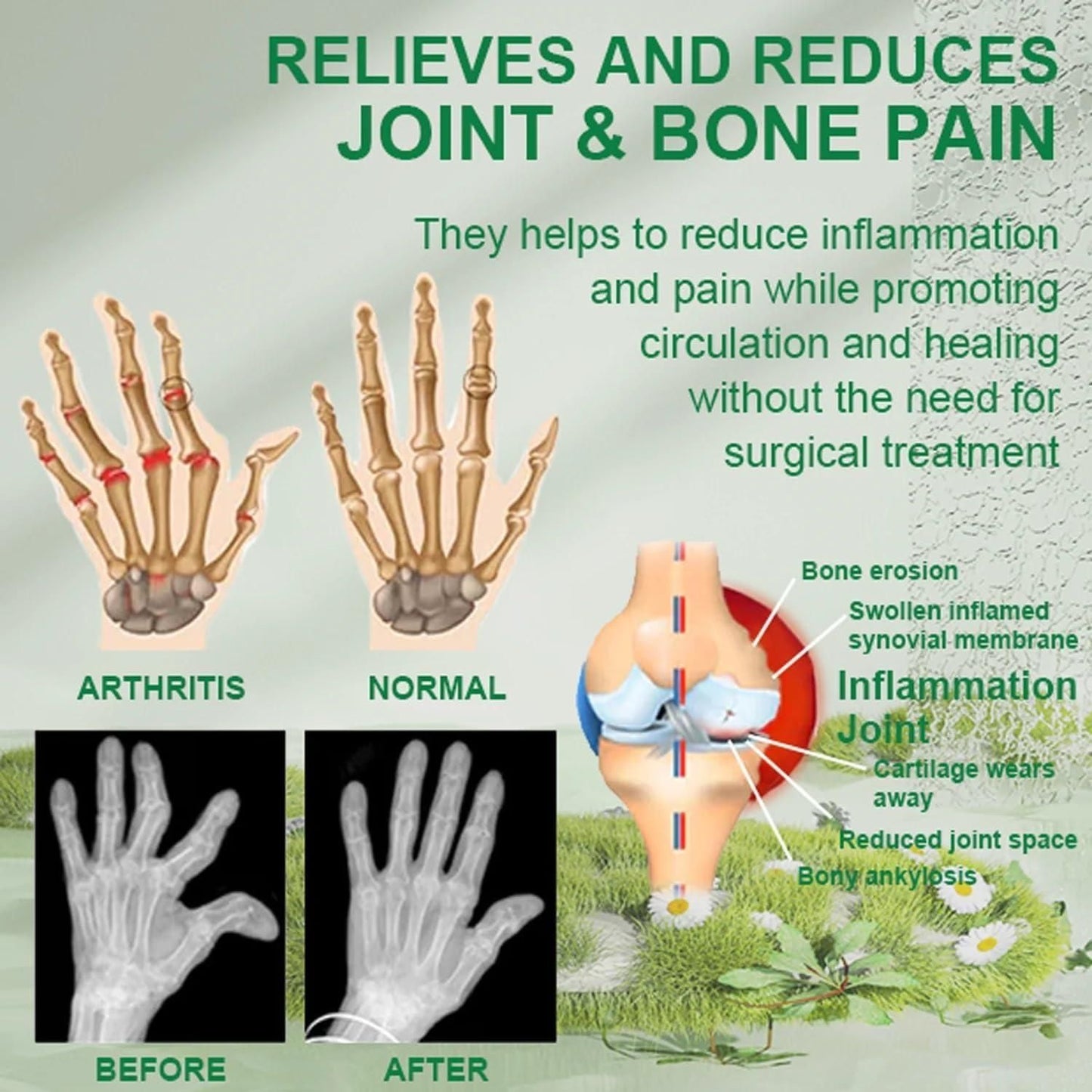 ❤️New Zealand's Discovery❤️ Bee Venom Joint and Bone Therapy Cream ( Buy 1, Get 1 FREE! 💕, Pack of 2) 🏆🏆 AWARD WINNING PRODUCT