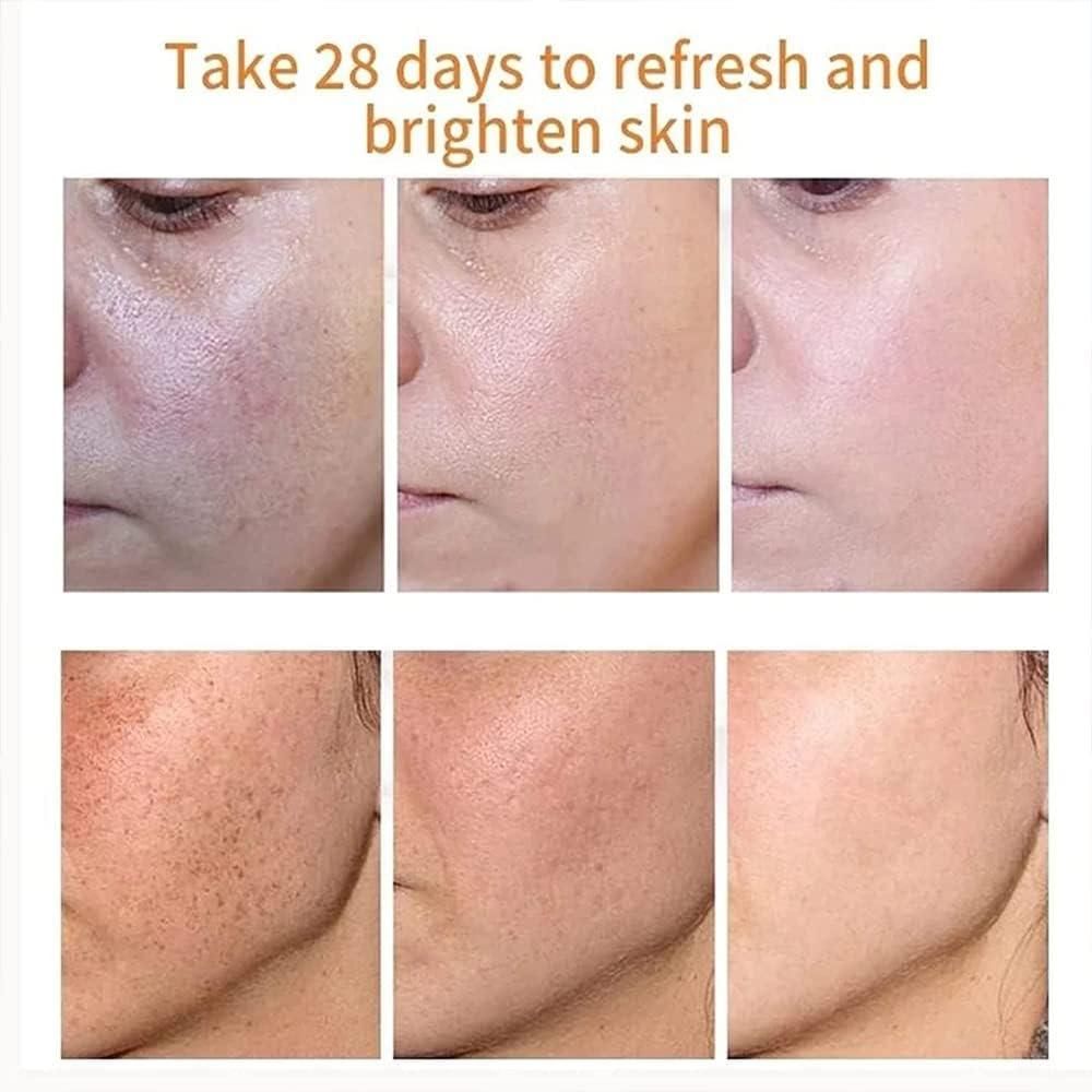🎉Last Day Promotion - 50% OFF🎉Japanese Melasma Cream - Herbal Whitening and Freckle-Removing Cream: Fades Spots and Brightens Skin Tone 🌟