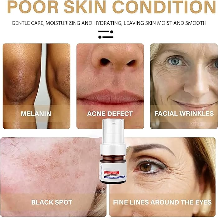 โค๏ธ ORIGINAL ๐๐ก๐ข๐ญ๐๐ง๐ข๐ง๐ and ๐
๐ซ๐๐๐ค๐ฅ๐ Removing Essence, Vitamin C ๐๐ฅ๐๐ฆ๐ข๐ฌ๐ก Serum for ๐๐๐ฅ๐๐ฌ๐ฆ๐ ๐๐๐ฆ๐จ๐ฏ๐๐ฅ, ๐๐ง๐ญ๐ข-๐ฌ๐ฉ๐จ๐ญ Face Serum (๐ฅBuy 1 Get 1 FREE Today Only) - Pack of 2