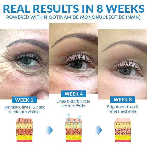 ORIGINAL™ Hydrating Retinol Caffeine No-Under-Spots-Eye Cream (🔥Buy 1 Get 1 FREE Today Only) (Pack of 2)