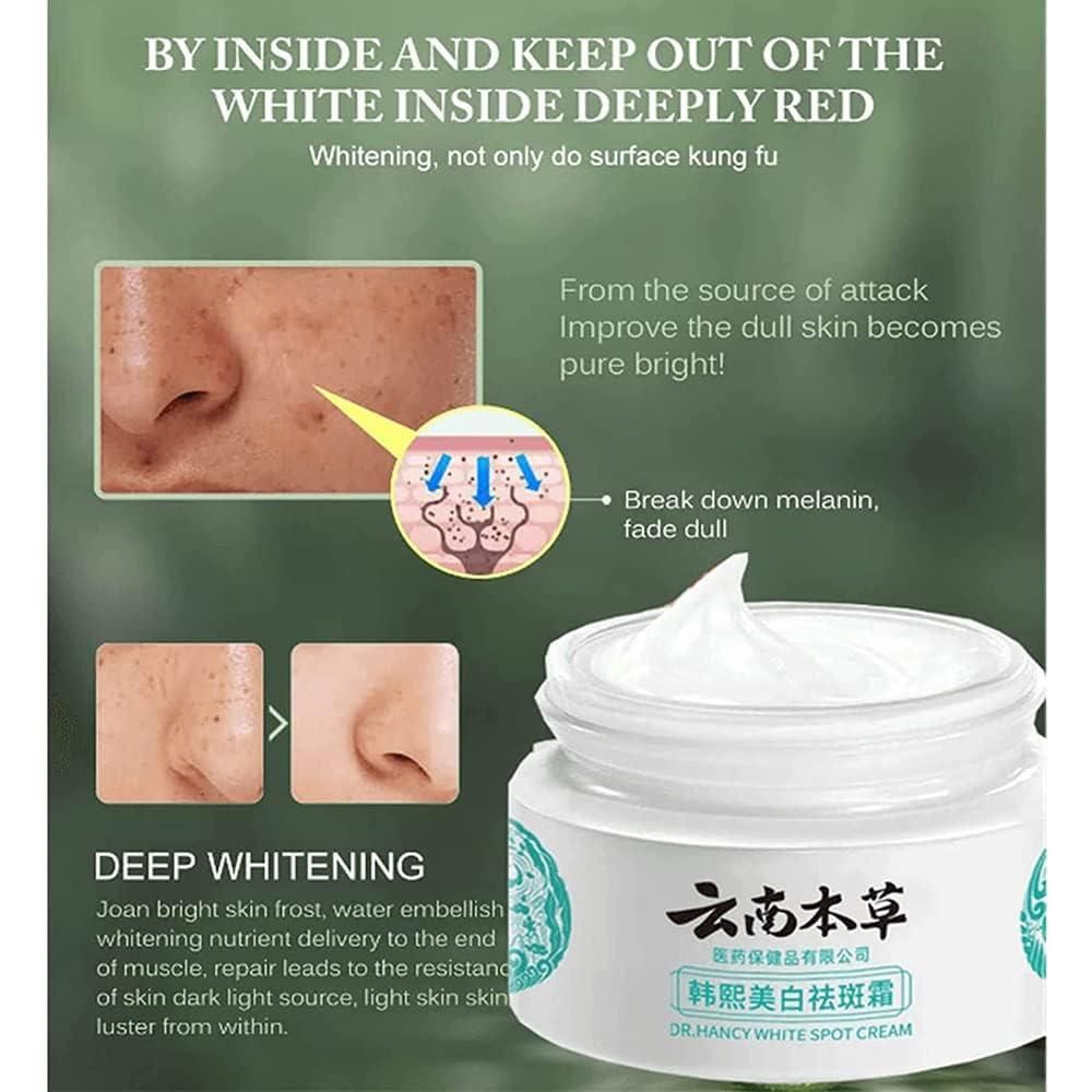 🎉Last Day Promotion - 50% OFF🎉Japanese Melasma Cream - Herbal Whitening and Freckle-Removing Cream: Fades Spots and Brightens Skin Tone 🌟