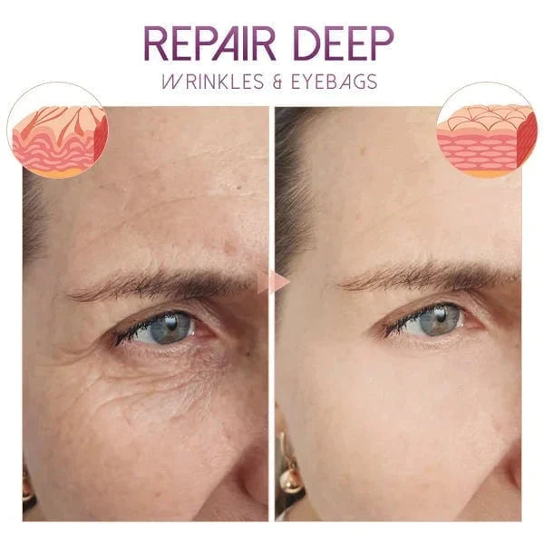 ORIGINAL™ Hydrating Retinol Caffeine No-Under-Spots-Eye Cream (🔥Buy 1 Get 1 FREE Today Only) (Pack of 2)