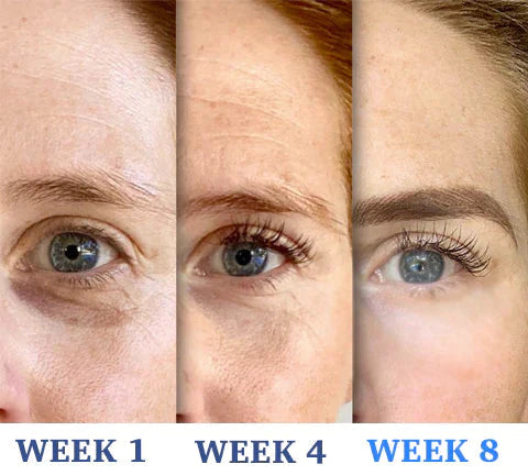 ORIGINAL™ Hydrating Retinol Caffeine No-Under-Spots-Eye Cream (🔥Buy 1 Get 1 FREE Today Only) (Pack of 2)
