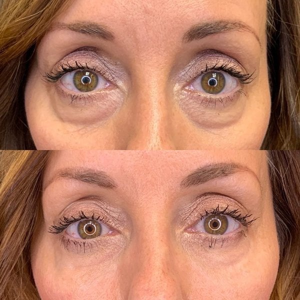 ORIGINAL™ Hydrating Retinol Caffeine No-Under-Spots-Eye Cream (🔥Buy 1 Get 1 FREE Today Only) (Pack of 2)