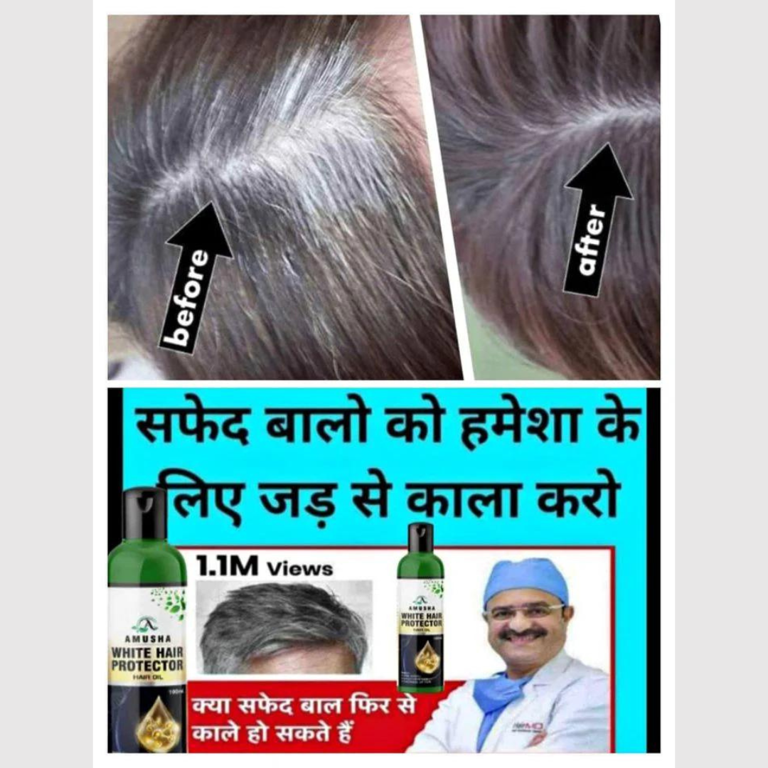 White Hair Protector Hair Oil - ❤️For Both Men & Women❤️🔥BUY 1 GET 1 FREE 🔥