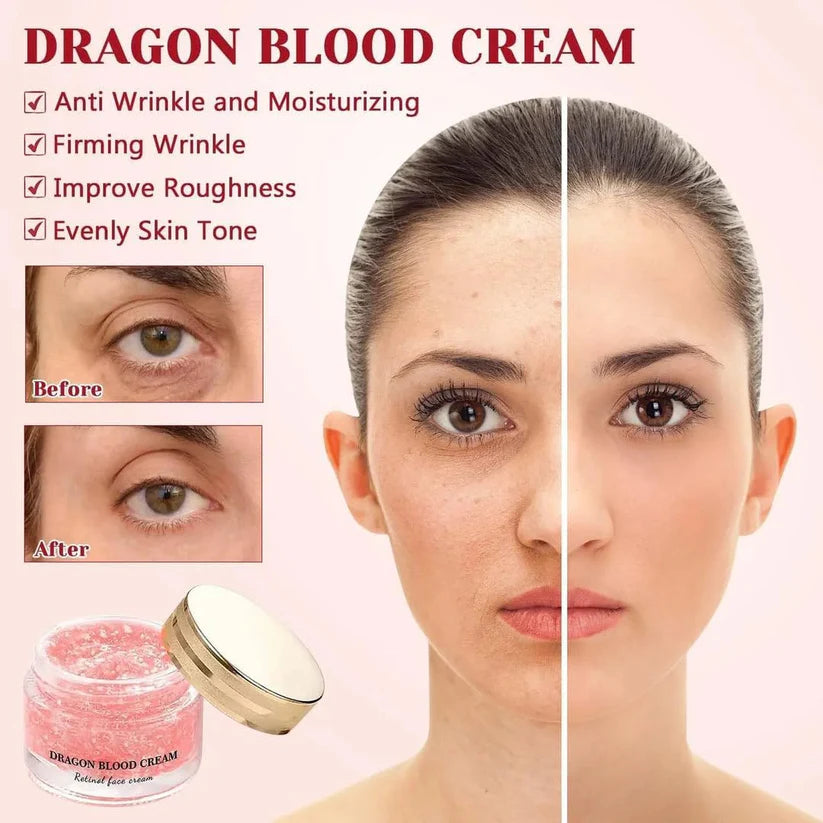 Korean Dragon Cream (PACK OF 2) 🔥For Both Men & Women🔥 (❤️BUY 1 GET 1 FREE❤️ Only For Today!)