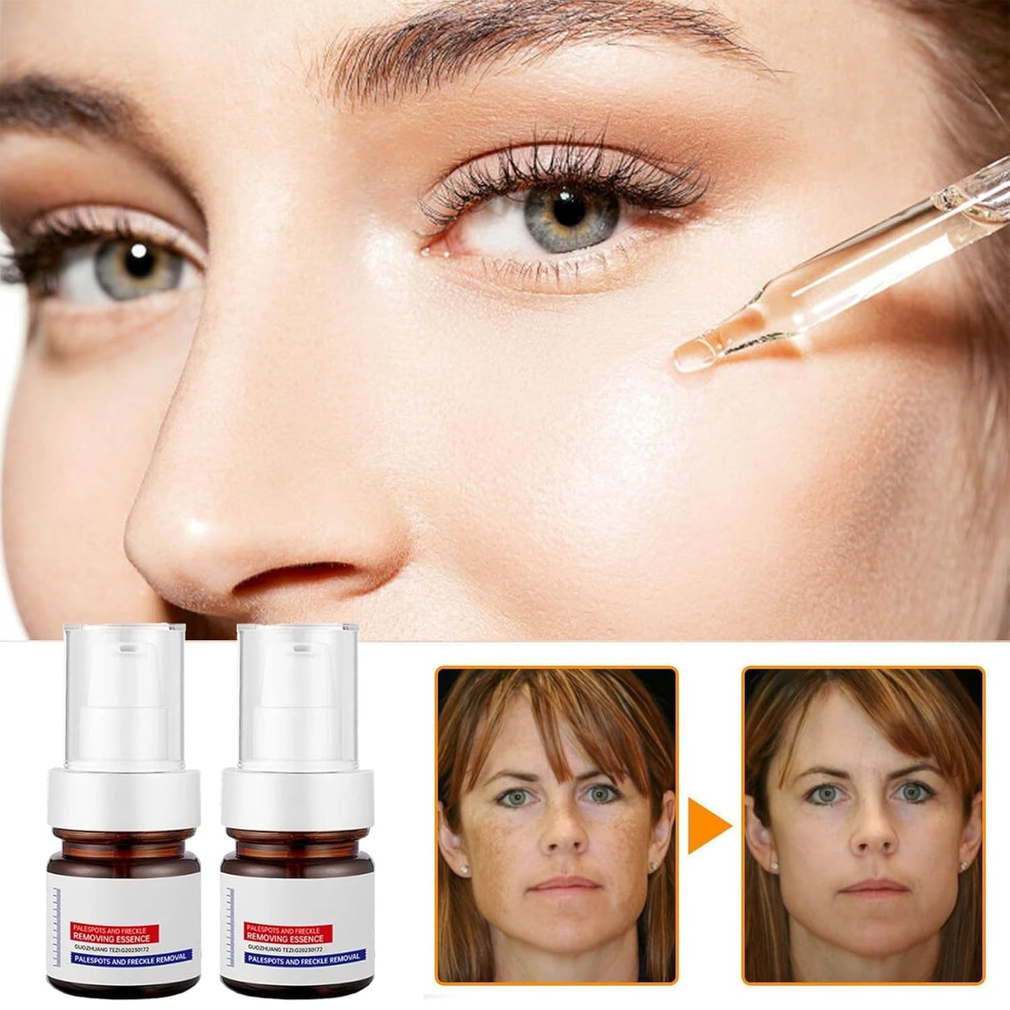 ❤️ ORIGINAL 𝐖𝐡𝐢𝐭𝐞𝐧𝐢𝐧𝐠 and 𝐅𝐫𝐞𝐜𝐤𝐥𝐞 Removing Essence, Vitamin C 𝐁𝐥𝐞𝐦𝐢𝐬𝐡 Serum for 𝐌𝐞𝐥𝐚𝐬𝐦𝐚 𝐑𝐞𝐦𝐨𝐯𝐚𝐥, 𝐀𝐧𝐭𝐢-𝐬𝐩𝐨𝐭 Face Serum (🔥Buy 1 Get 1 FREE Today Only) - Pack of 2