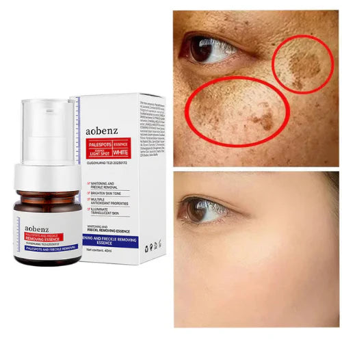 ❤️ ORIGINAL 𝐖𝐡𝐢𝐭𝐞𝐧𝐢𝐧𝐠 and 𝐅𝐫𝐞𝐜𝐤𝐥𝐞 Removing Essence, Vitamin C 𝐁𝐥𝐞𝐦𝐢𝐬𝐡 Serum for 𝐌𝐞𝐥𝐚𝐬𝐦𝐚 𝐑𝐞𝐦𝐨𝐯𝐚𝐥, 𝐀𝐧𝐭𝐢-𝐬𝐩𝐨𝐭 Face Serum (🔥Buy 1 Get 1 FREE Today Only) - Pack of 2