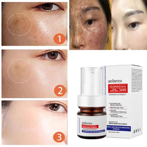 ❤️ ORIGINAL 𝐖𝐡𝐢𝐭𝐞𝐧𝐢𝐧𝐠 and 𝐅𝐫𝐞𝐜𝐤𝐥𝐞 Removing Essence, Vitamin C 𝐁𝐥𝐞𝐦𝐢𝐬𝐡 Serum for 𝐌𝐞𝐥𝐚𝐬𝐦𝐚 𝐑𝐞𝐦𝐨𝐯𝐚𝐥, 𝐀𝐧𝐭𝐢-𝐬𝐩𝐨𝐭 Face Serum (🔥Buy 1 Get 1 FREE Today Only) - Pack of 2