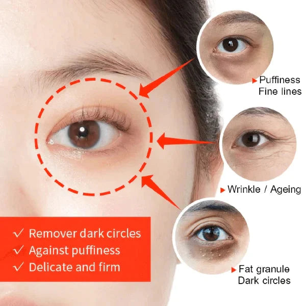 ORIGINAL™ Hydrating Retinol Caffeine No-Under-Spots-Eye Cream (🔥Buy 1 Get 1 FREE Today Only) (Pack of 2)
