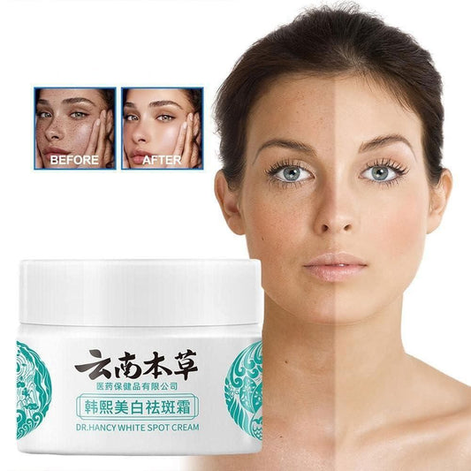 🎉Last Day Promotion - 50% OFF🎉Japanese Melasma Cream - Herbal Whitening and Freckle-Removing Cream: Fades Spots and Brightens Skin Tone 🌟