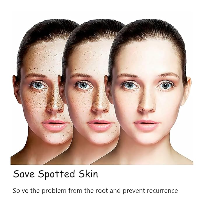 ❤️ ORIGINAL 𝐖𝐡𝐢𝐭𝐞𝐧𝐢𝐧𝐠 and 𝐅𝐫𝐞𝐜𝐤𝐥𝐞 Removing Essence, Vitamin C 𝐁𝐥𝐞𝐦𝐢𝐬𝐡 Serum for 𝐌𝐞𝐥𝐚𝐬𝐦𝐚 𝐑𝐞𝐦𝐨𝐯𝐚𝐥, 𝐀𝐧𝐭𝐢-𝐬𝐩𝐨𝐭 Face Serum (🔥Buy 1 Get 1 FREE Today Only) - Pack of 2